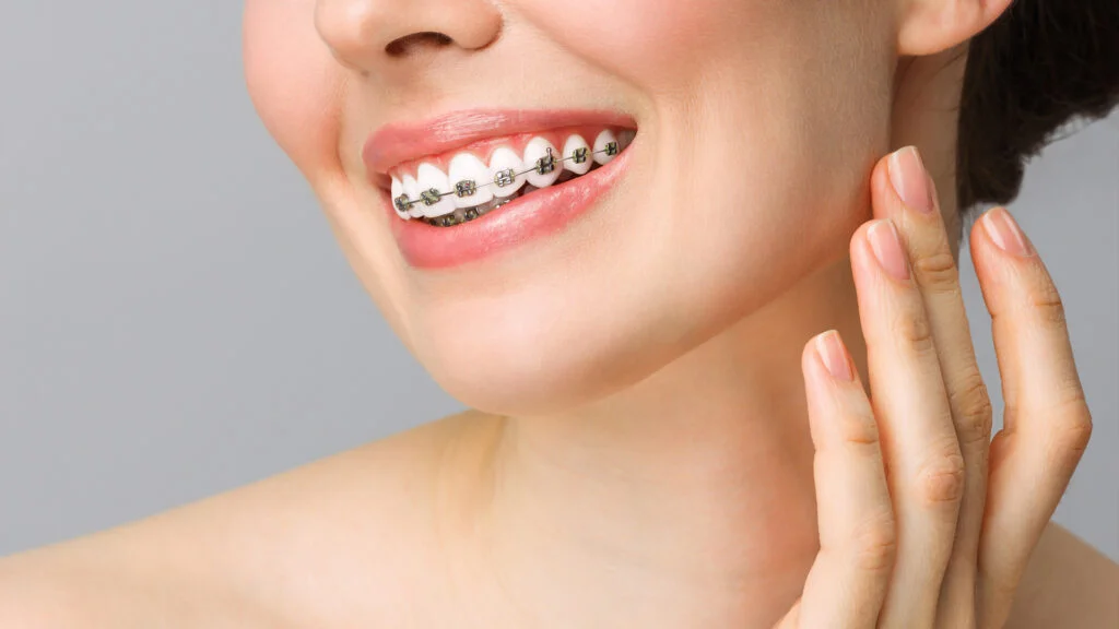 Zâmbet armonios — DentalCare Sîrbu Cluj